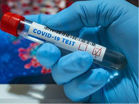 Нардепам предложили купить сертификаты иммунитета к COVID-19
